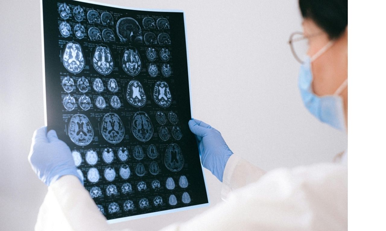 Doctor reviewing results of discounted & low-cost diagnostic imaging in Houston to provide affordable healthcare.