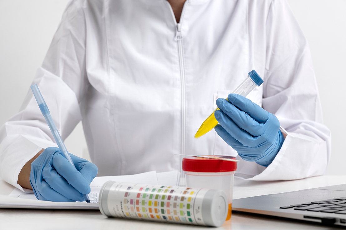 A medical professional performing lab analysis for rapid tests in Houston using a diagnostic sample and test strips.